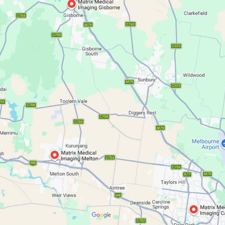 MMI_Location